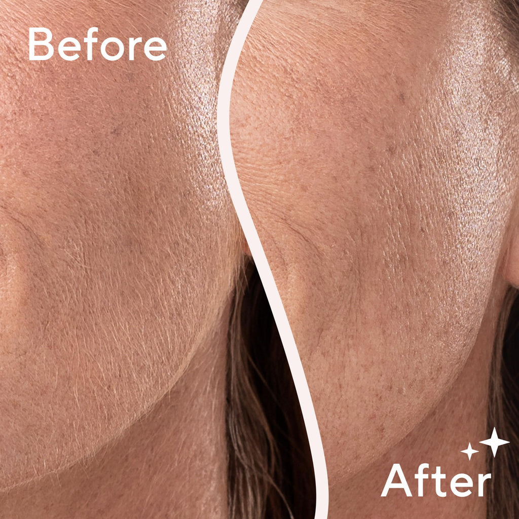 Lighted Electric Facial Exfoliator with 6 Replacement Heads O822